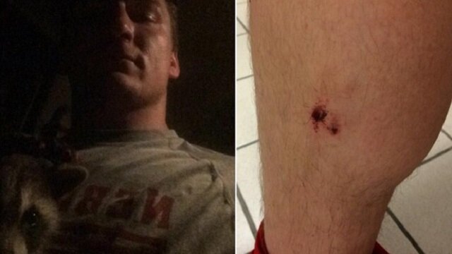 Nebraska Football Player Takes Picture With Raccoon, Gets Bit, Kills Raccoon